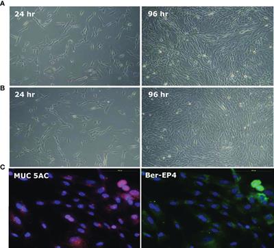 Differential H. pylori-Induced MAPK Responses Regulate Lewis Antigen Expression and Colonization Density on Gastric Epithelial Cells Between Children and Adults